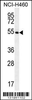 GSR Antibody (C-term)