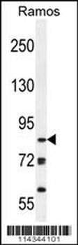 JHDM2b Antibody (Center)