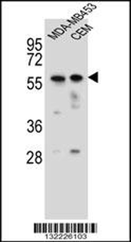 FOXD4 Antibody (Center)