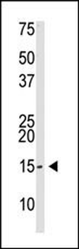 SUMO2/3 Antibody (Center)