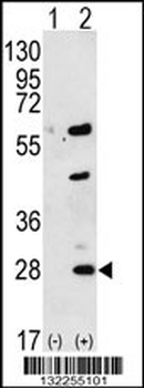 GREM1 Antibody (C-term)