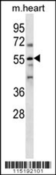 PARP2 Antibody (N-term)