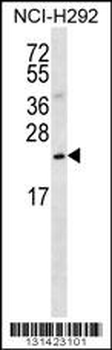 SLMO2 Antibody (Center)