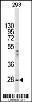 EIF2B1 Antibody (Center)