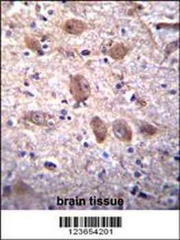 SPG7 Antibody (Center)