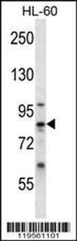 CAPN6 Antibody (Center)