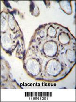 CAPN6 Antibody (Center)