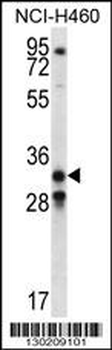 GDF15 Antibody (N-term)