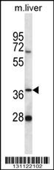 PNKD Antibody (N-term)
