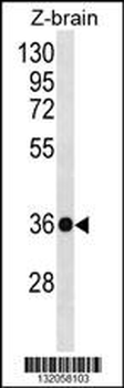 HOXD10 Antibody (C-term)