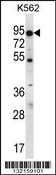 ABCD2 Antibody (C-term)