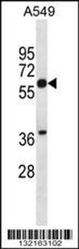 SQLE Antibody (N-term)