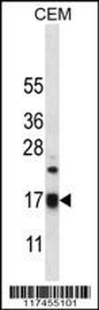 MRPS12 Antibody (Center K43)