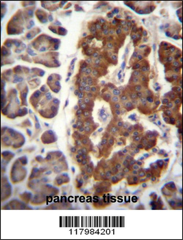 DPT Antibody (N-term)