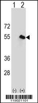 CPN1 Antibody (Center)
