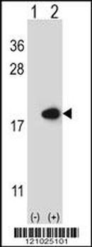 FABP2 Antibody (N-term)