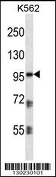 PKP2 Antibody (C-term)