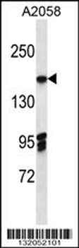 EIF3A Antibody (C-term)