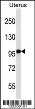 FGD4 Antibody (N-term)