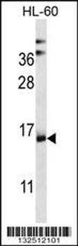 NDUFAF4 Antibody (N-term)