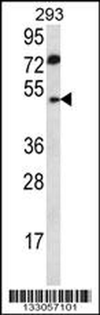 ABHD2 Antibody (Center)