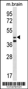 ORC5L Antibody (Center)