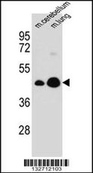 ITM2B Antibody (C-term)