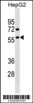 TRIM13 Antibody (N-term)
