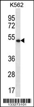 APOBEC3G Antibody (C-term)