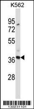 CLEC7A Antibody (N-term)