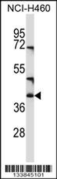 CD1C Antibody (C-term)