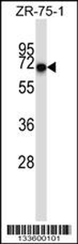 CD5 Antibody (Center)