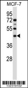 SGMS1 Antibody (N-term)