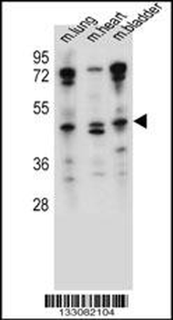 NKD1 Antibody (N-term)