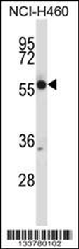 CRMP1 Antibody (N-term)
