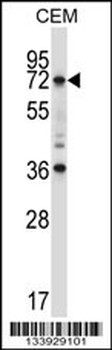 RORC Antibody (Center)