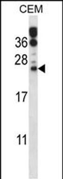RAB6B Antibody (C-term)