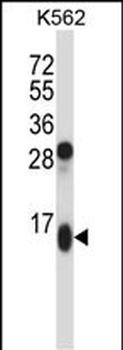 GUCA2A Antibody (Center)