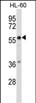 MCOLN3 Antibody (C-term)