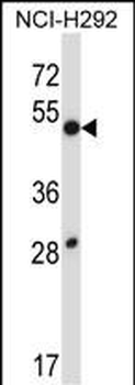 DUSP9 Antibody (C-term)