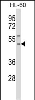 TACR1 Antibody (Center)