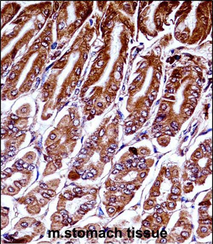 Mouse Map3k7 Antibody (N-term)