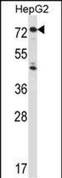 IL1R1 Antibody (C-term)