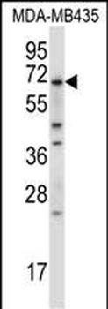 BIRC3 Antibody (N-term)