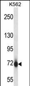 Mouse Pak7 Antibody (N-term)