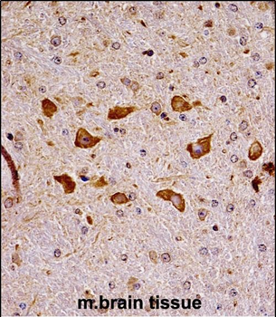 Mouse Pak7 Antibody (N-term)