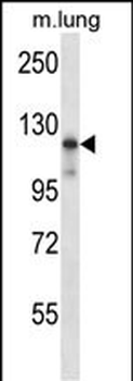 Mouse Map3k14 Antibody (C-term)