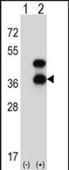 CD72 Antibody (Center)