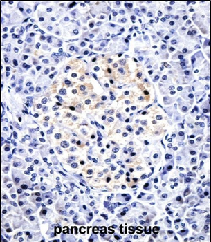 CCL15 Antibody (C-term)