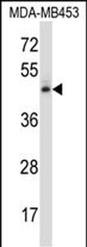 NR2F1 Antibody (N-term)